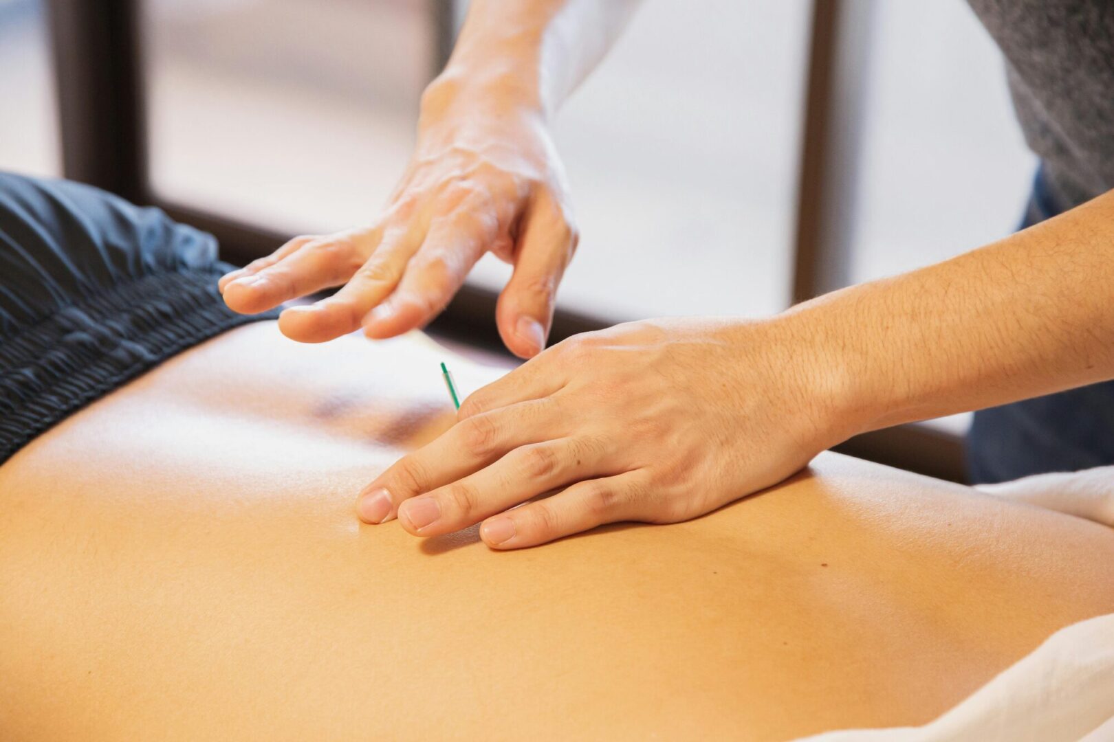 Person får akupunktur i maven